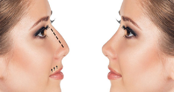 اقدامات قبل و بعد از جراحی بینی