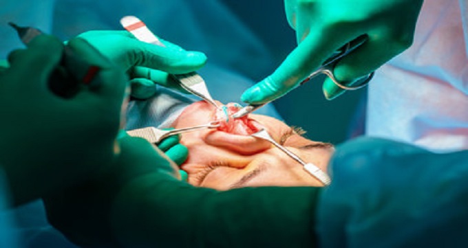 روش های جراحی بینی