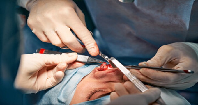 اهمیت انتخاب پزشک جراحی بینی