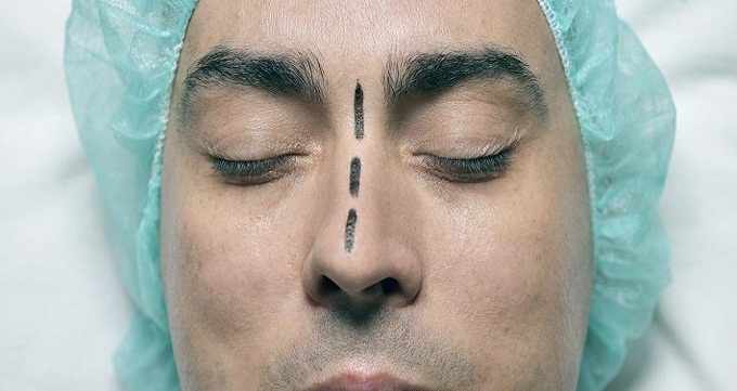 جراحی بینی طبیعی مردانه
