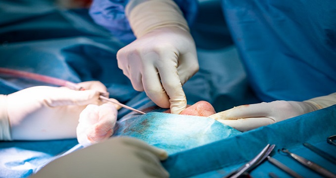 انواع عمل جراحی بینی